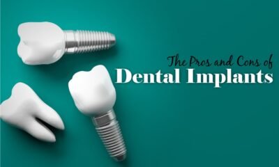 The Pros and Cons of Dental Implants