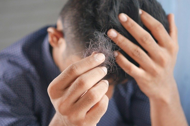 Signs Hair Thinning