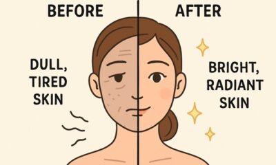 common causes of dull and tired-looking skin