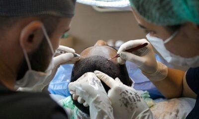 Hair Transplant Technology Istanbul