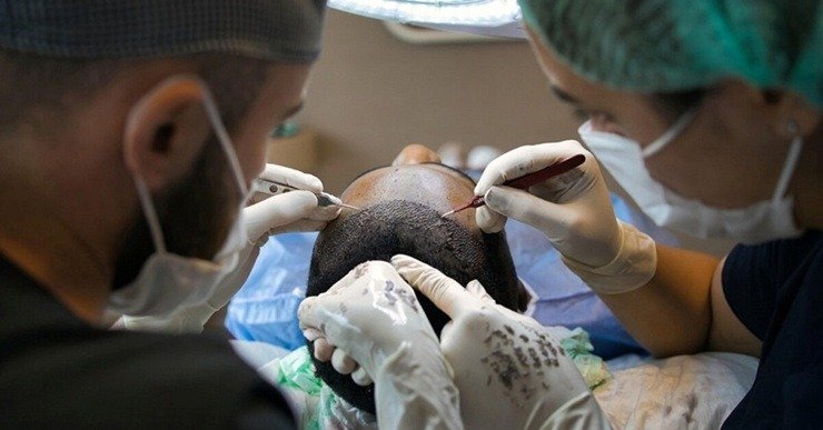 Hair Transplant Technology Istanbul